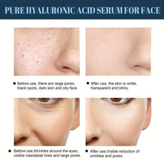 Protein Lifting Threading Set With Collagen Serum