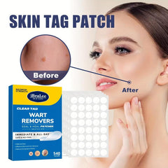 Skin Tag Remover Patches Hydrocolloid Acne Pimple Patch - 540pcs
