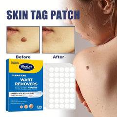 Skin Tag Remover Patches Hydrocolloid Acne Pimple Patch - 540pcs