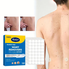 Skin Tag Remover Patches Hydrocolloid Acne Pimple Patch - 540pcs
