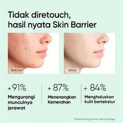 Acne Pit Repair Cream Fade Red Swollen Acne Scars