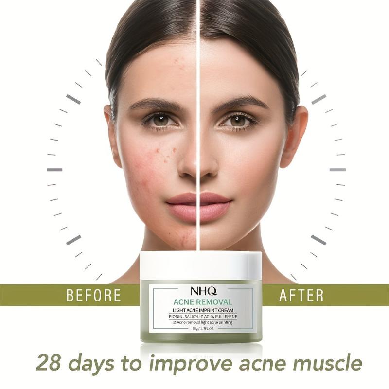 Acne Pit Repair Cream Fade Red Swollen Acne Scars