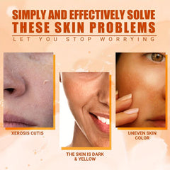 Acne Removal Cream Acne Pit Repair Fade Red Swollen Acne Scar Removal