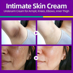 Dark Spot Corrector Cream for Intimate Areas 50ml