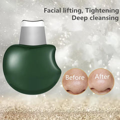 Blackhead Removal Scraper Facial Skin Cleaning Tool