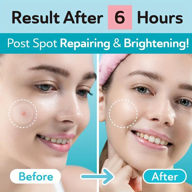Acne Patches Hydrocolloid Pimple Patch Zits Blemishes Spot Stickers