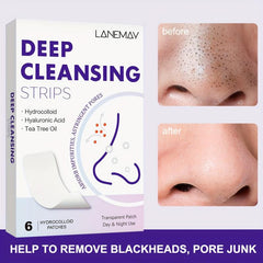 6 Charcoal Pore Strips for Blackhead Removal on Oily Skin