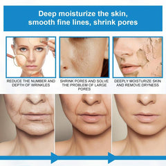 Hyaluronic Acid Serum for Face - Wrinkle Fader - Moisturizer for Dry Skin