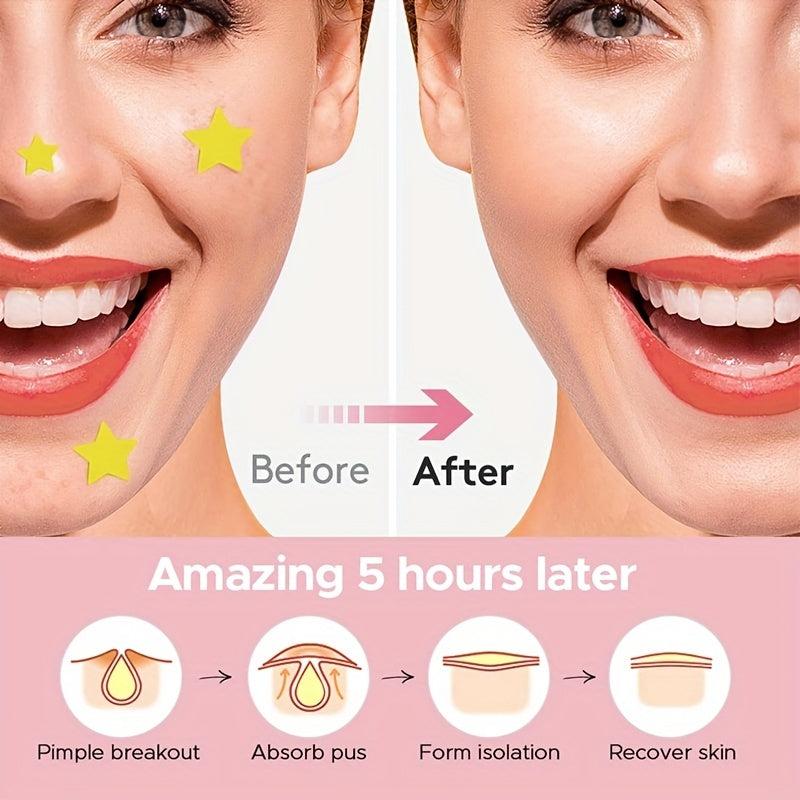 224pcs Acne Patch Pimple Cover Patch Hydrocolloid Acne Patches For Face