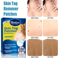 Skin Tag Patches Hydrocolloid Acne Pimple Patch Zits Blemishes
