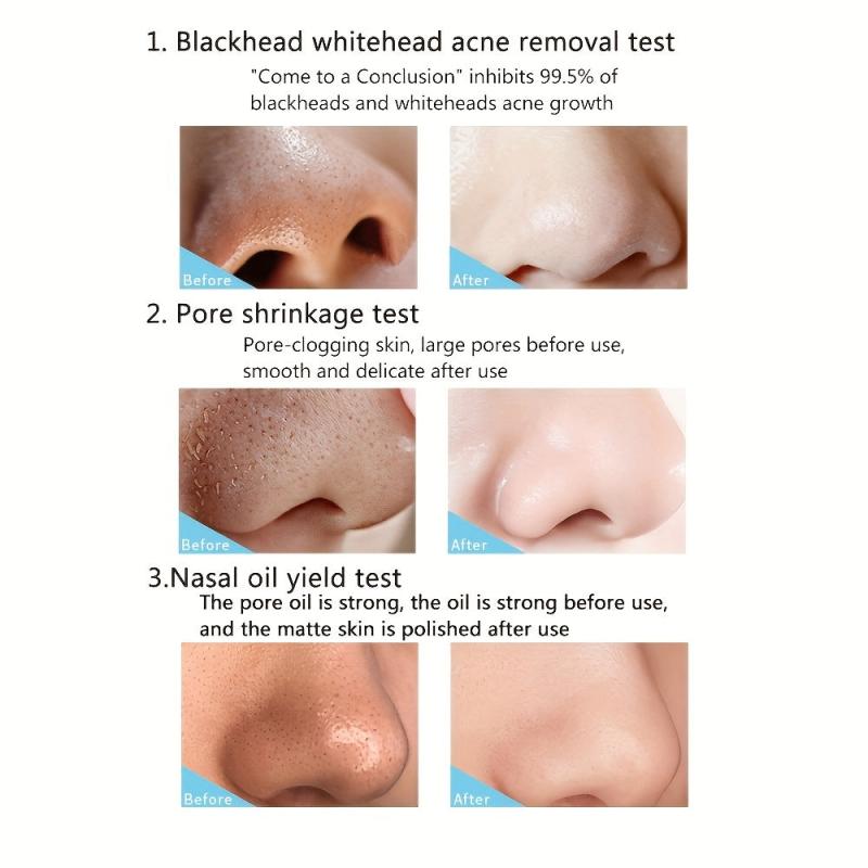 6pcs Charcoal Nose Patch Remove Blackheads Unisex