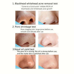 6pcs Charcoal Nose Patch Remove Blackheads Unisex