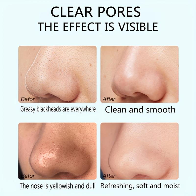 6pcs Charcoal Nose Patch Remove Blackheads Unisex