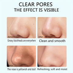 6pcs Charcoal Nose Patch Remove Blackheads Unisex