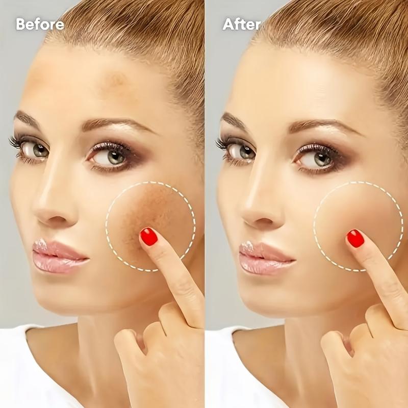 Hyperpigmentation Care Cream - Dark Spot Corrector for Face