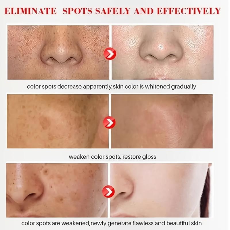 Hyperpigmentation Care Cream - Dark Spot Corrector for Face