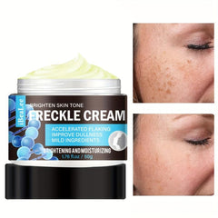 Hyperpigmentation Care Cream - Dark Spot Corrector for Face