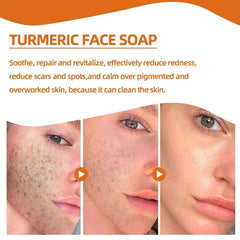 Turmeric Face Wash Soap for Gentle Cleansing & Repair