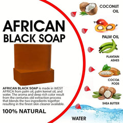 Organic African Soap for Acne & Dark Spots - 2 Bars x 65g Each