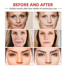 Wrinkle Diminishing Cream with Hyaluronic Acid & Vitamin C