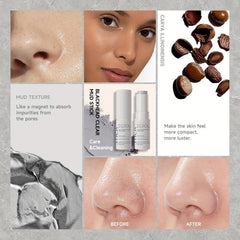 3 Pack Blackhead Removal Sticks for Lazy Girl Head Remover