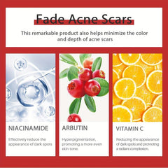 VC Acne Removal Niacinamide Dark Spot Reducing Cream 30ml