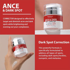 VC Acne Removal Niacinamide Dark Spot Reducing Cream 30ml