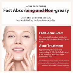 VC Acne Removal Niacinamide Dark Spot Reducing Cream 30ml