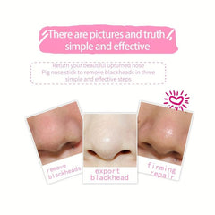 Blackhead Removal Strips for Women&Men
