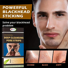 Blackhead Remover Nose Patch 50pcs - Deep Cleansing Pores
