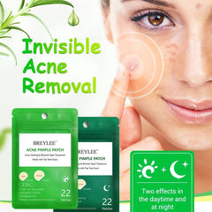 Pore Strips Pimple Patches Acne Stickers