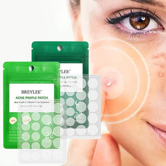 Pore Strips Pimple Patches Acne Stickers