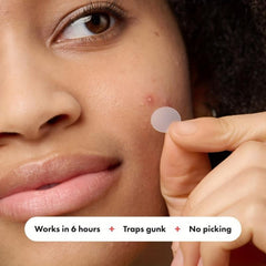 108pcs Acne Patches Hydrocolloid Spot Stickers for Face Skin