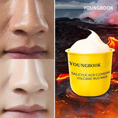 Salicylic Acid Acne Removal Face Cleaning Mud Film 10pcs