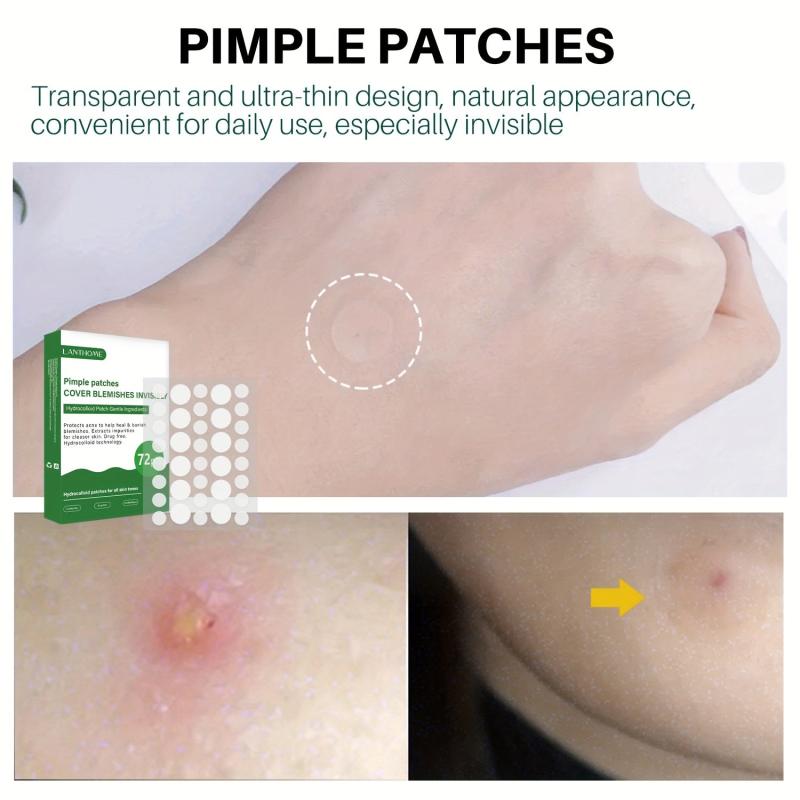 Acne Patch For Fading Acne Marks And Skin Care 72pcs
