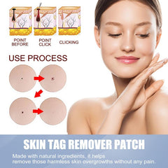 144pc Hydrocolloid Acne Pimple Patches for Face & Skin