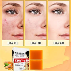 Turmeric Soap with Hyaluronic Acid Vitamin C Retinoic Acid Collagen 65g