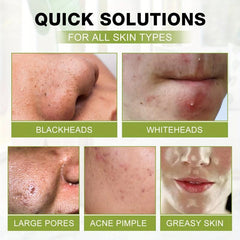 Bamboo Charcoal Peel Off Cleansing Mud Mask Blackhead Cleansing Pore Cleanser