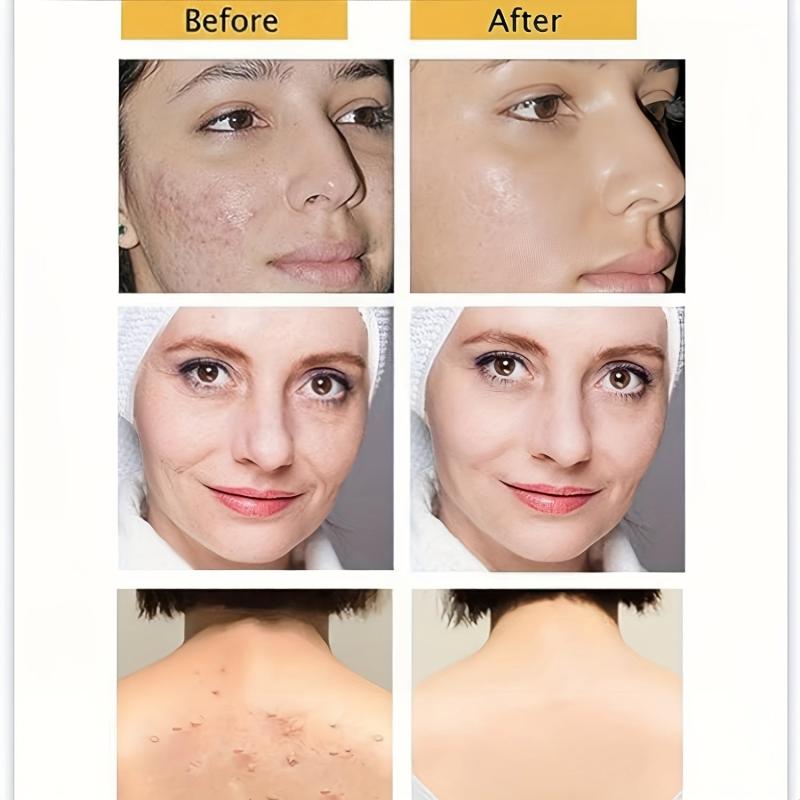 Yeast Soap Hyaluronic Acid Vitamin C Retinoic Acid Collagen for Face