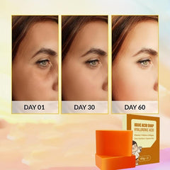 Yeast Soap Hyaluronic Acid Vitamin C Retinoic Acid Collagen for Face