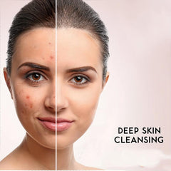 Yeast Soap Hyaluronic Acid Vitamin C Retinoic Acid Collagen for Face