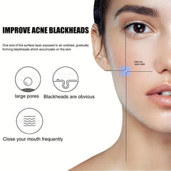 Blackhead Removal Nose Mask Clear Acne Pores