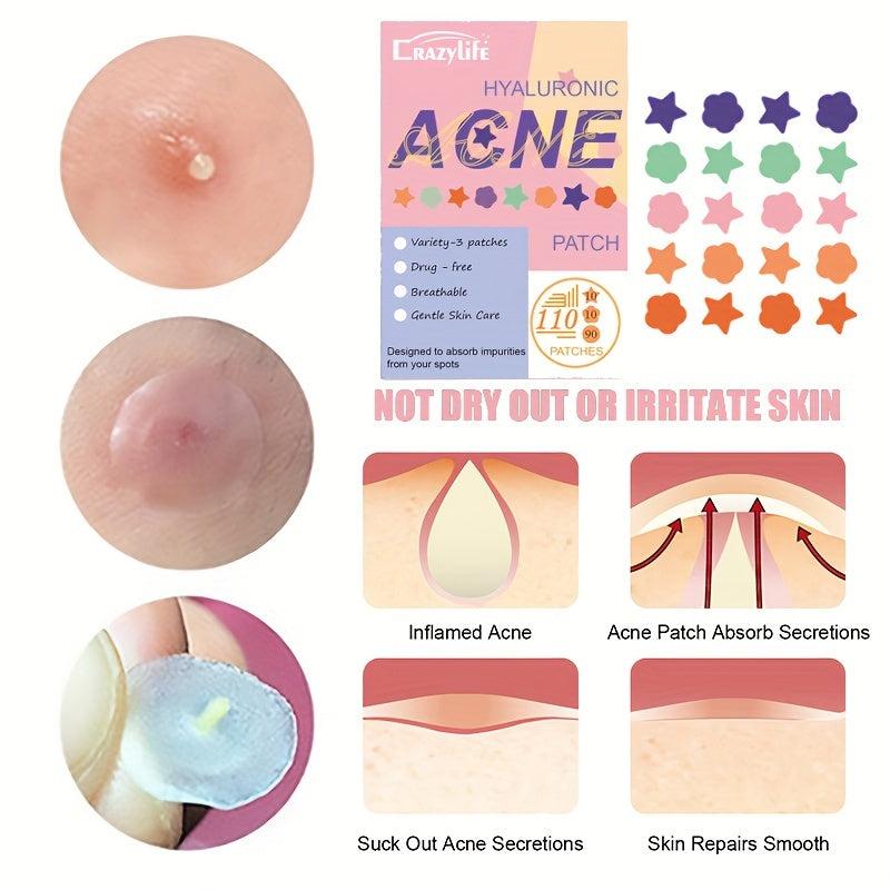 Colorful Acne Stickers 110 Stickers Star Flower Round Shape Acne Sticker