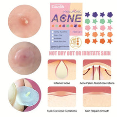 Colorful Acne Stickers 110 Stickers Star Flower Round Shape Acne Sticker