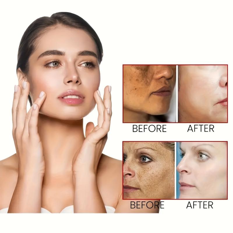 Dark Spot Remover Cream for Face & Body - Fades Spots on Armpits, Neck, Knees