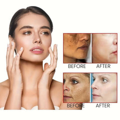 Dark Spot Remover Cream for Face & Body - Fades Spots on Armpits, Neck, Knees