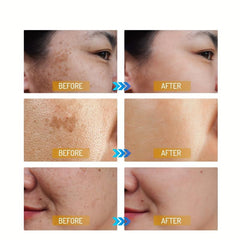 Dark Spot Remover Cream for Face & Body - Fades Spots on Armpits, Neck, Knees