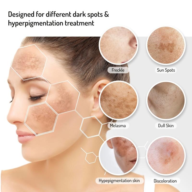 Dark Spot Remover Cream for Face & Body - Fades Spots on Armpits, Neck, Knees