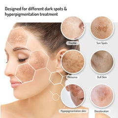 Dark Spot Remover Cream for Face & Body - Fades Spots on Armpits, Neck, Knees