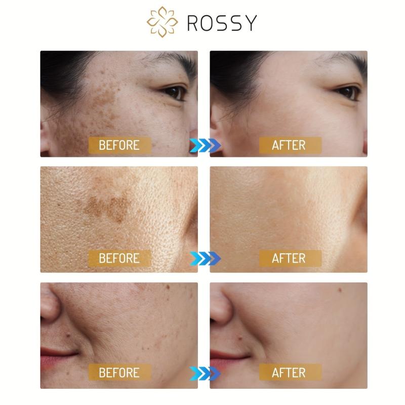 Retinol Facial Cream Collagen & Retinol Moisturizer